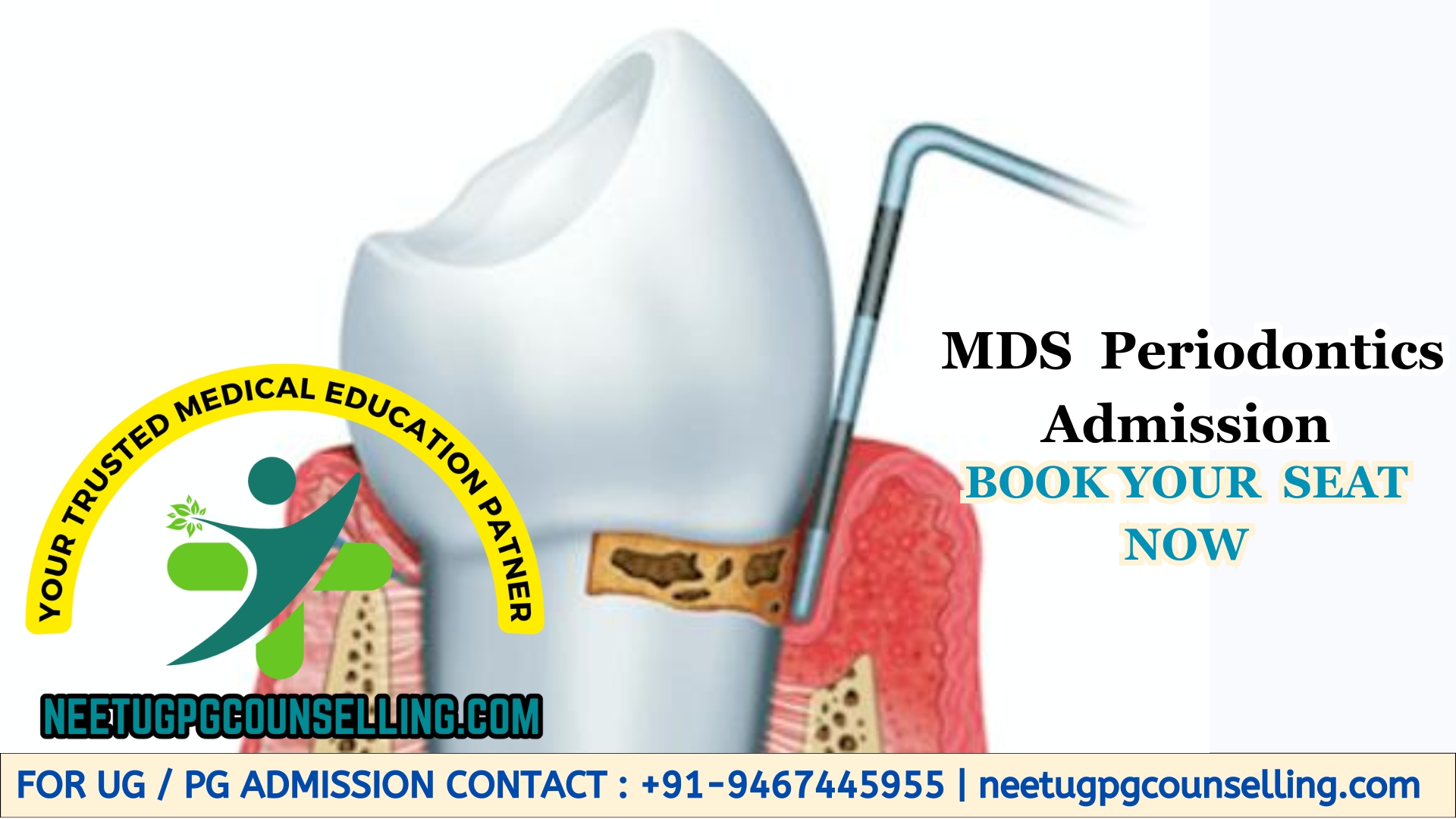 MDS Periodontics